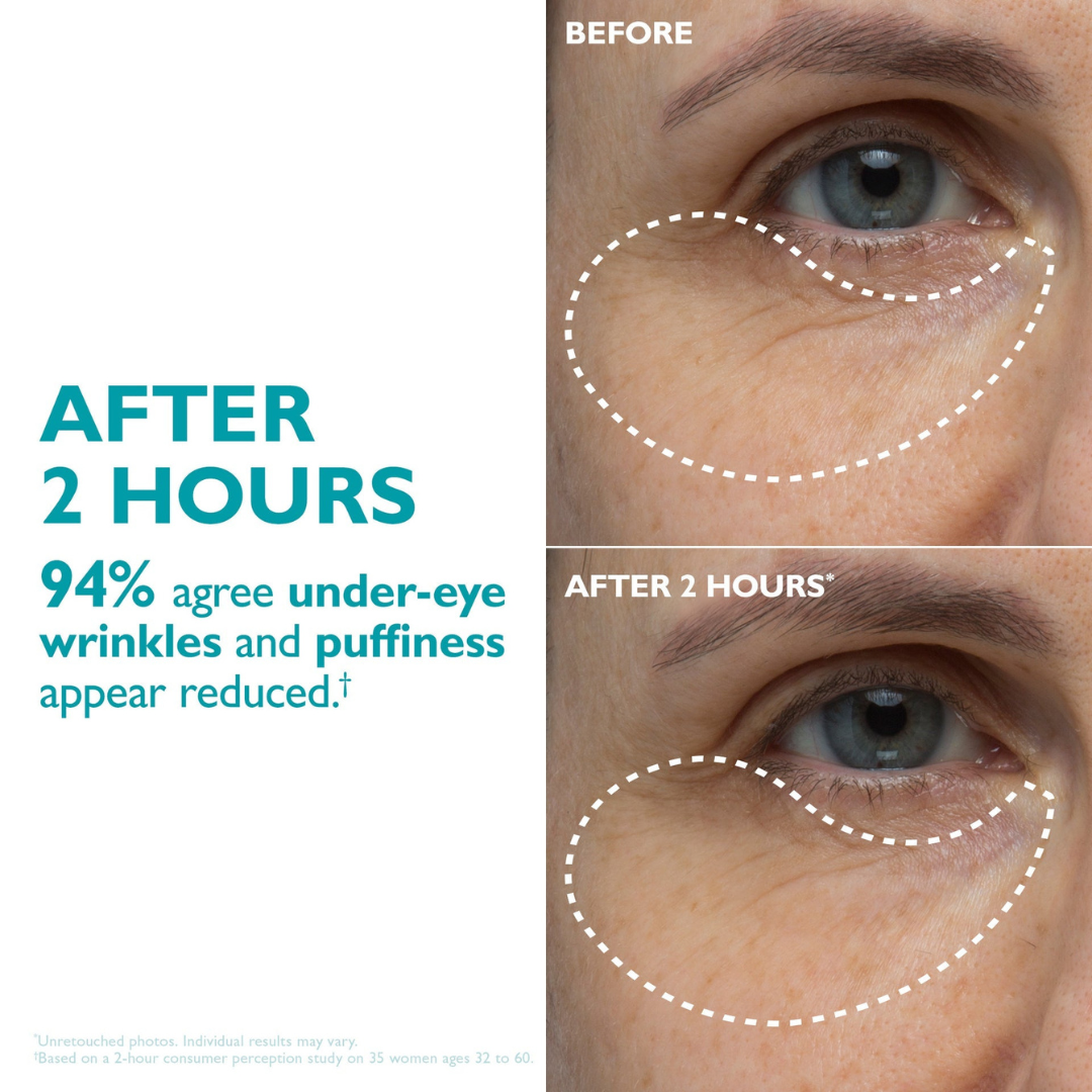 Veypora™ Peptide-Infused Face & Eye Tape