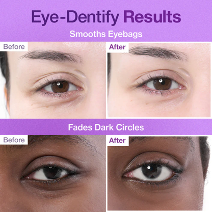 Zuvani™ NAD+ Retinol Eye Cream