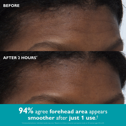 Veypora™ Peptide-Infused Face & Eye Tape